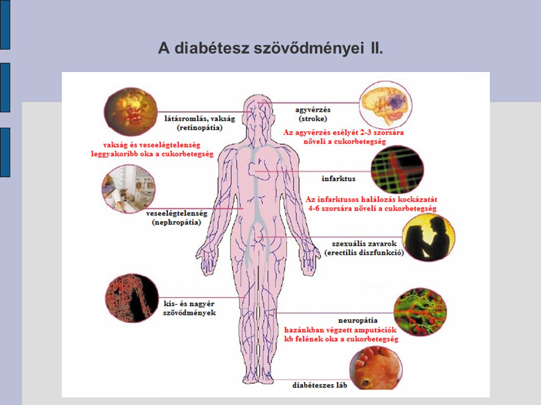 A cukorbetegség szövődményei