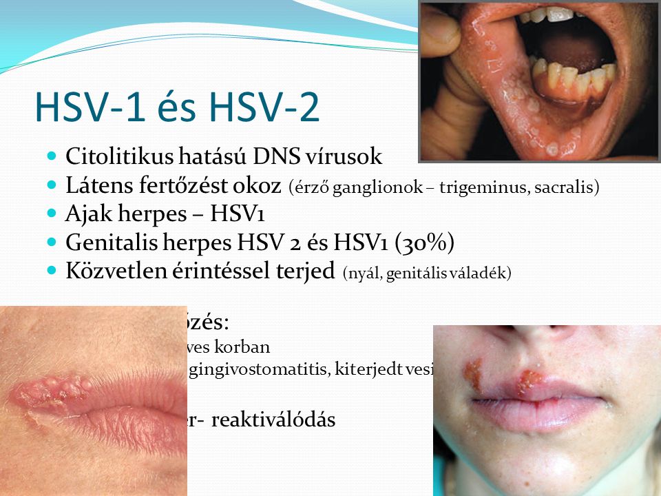 HSV-1 és HSV-2 Citolitikus hatású DNS vírusok