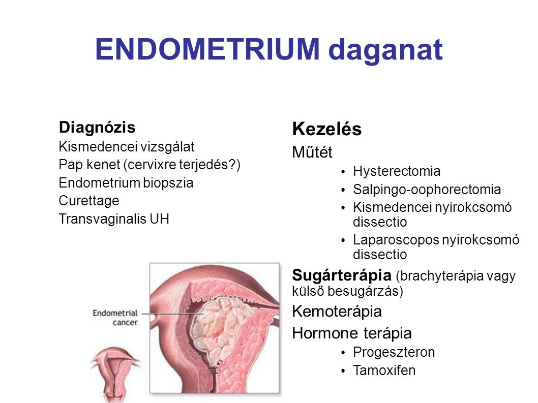 endometrium rák kezelési lehetőségei)