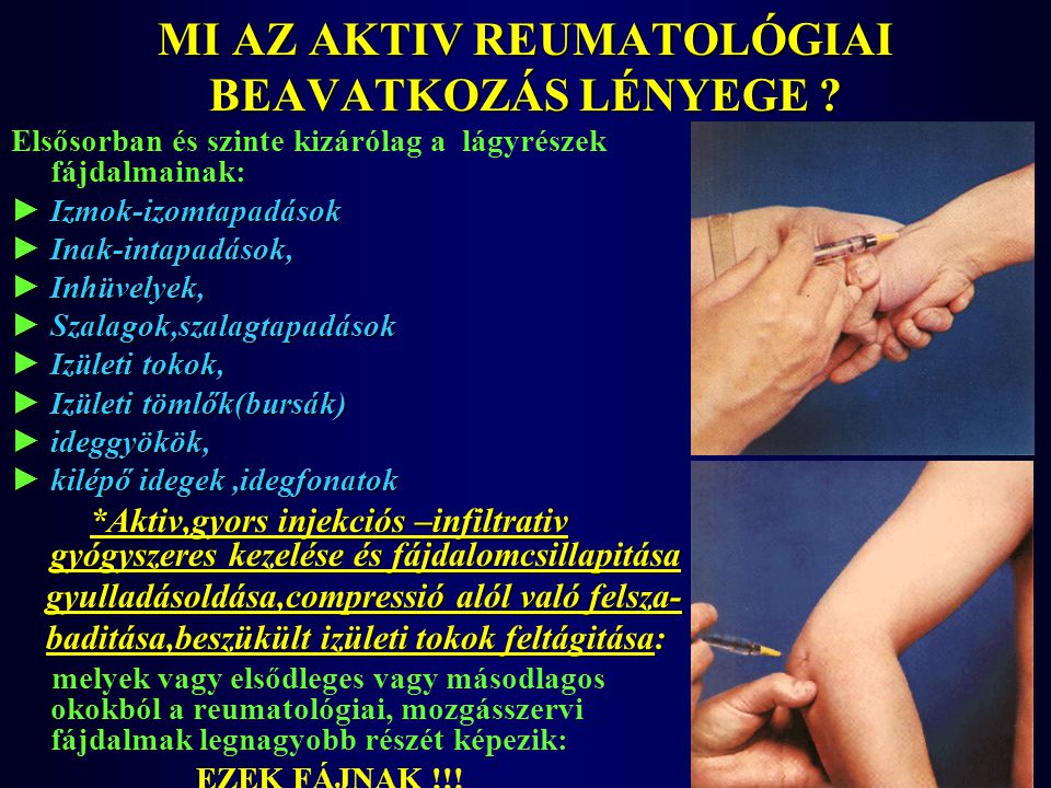reumatológiai intézet arthrosis kezelés