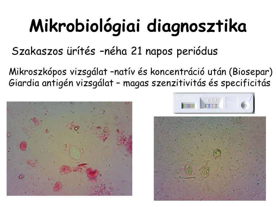 schistosomiasis kvalitatív vizsgálat)